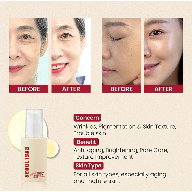 Seoul 1988 Bright & Firm Eye Cream