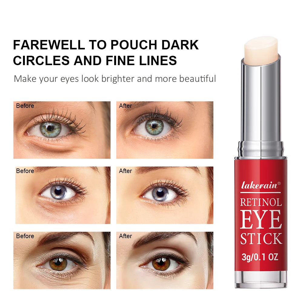 Retinol Eye Cream – Dark Circle & Firming