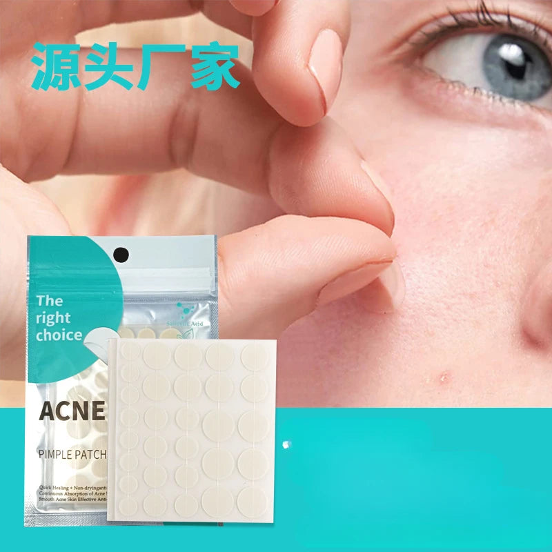 Acne Pimple Patch – 30/36pcs
