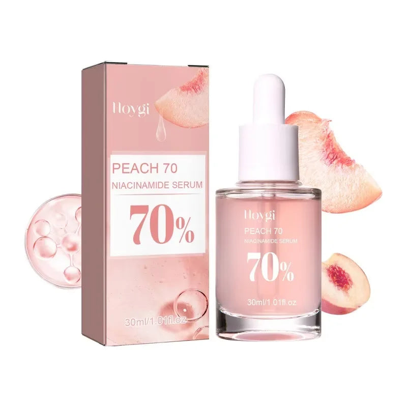 Niacinamide Serum – Dark Spot & Even Tone