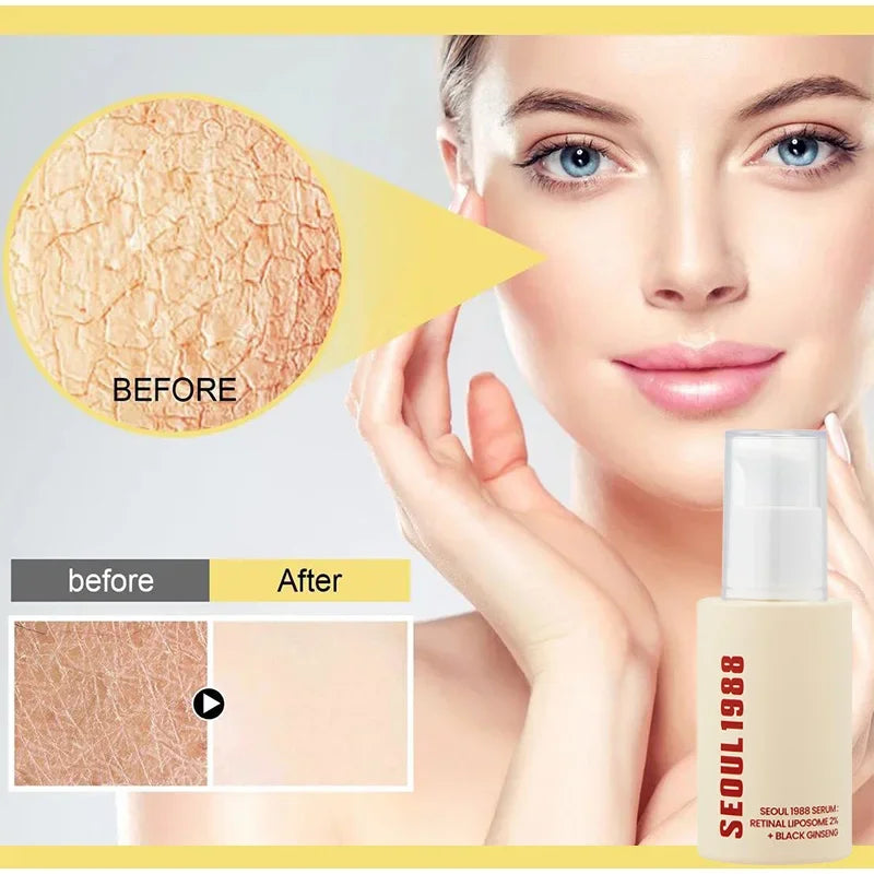 Seoul 1988 Bright & Firm Eye Cream